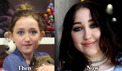 noah cyrus nose job|Noah Cyrus debuts dramatic face transformation after her mum。